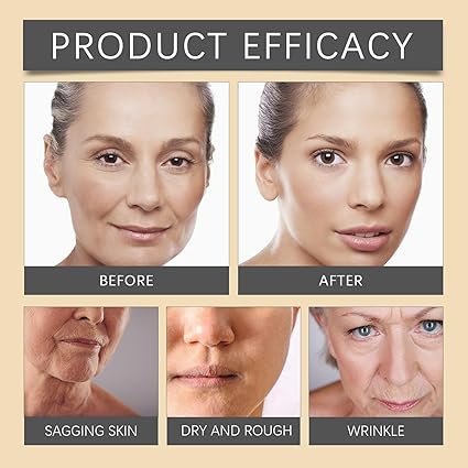 Botox Wrinkle Cream
